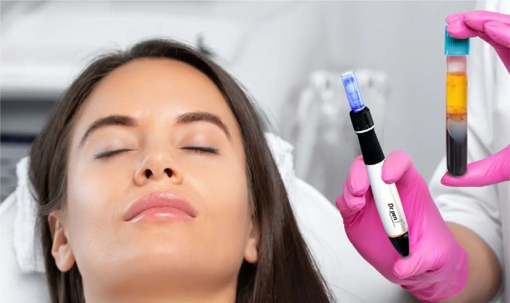 PRP — Plasma Rico en Plaquetas